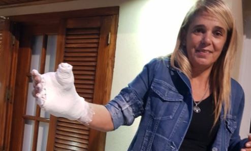 Se quebró la mano, pero la atendió una modista | Redes