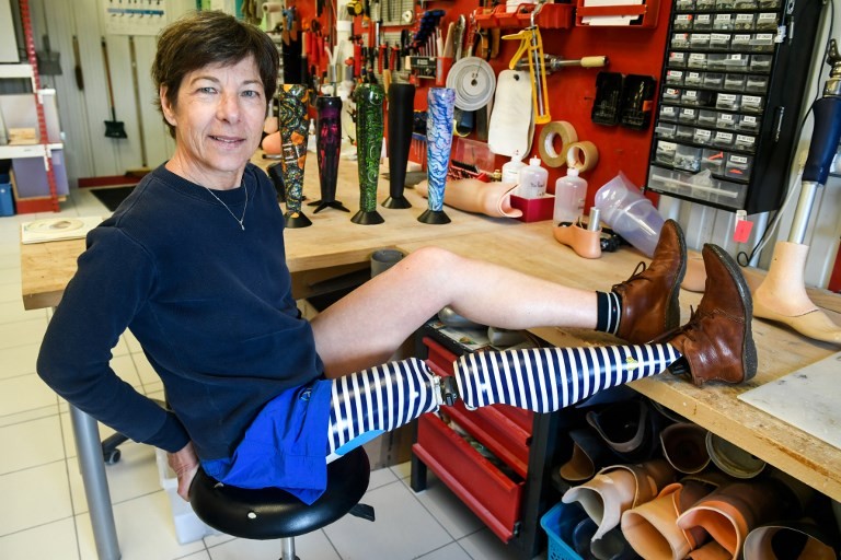 "La gente te mira de forma diferente cuando llevás una prótesis de colores" | Internacionales