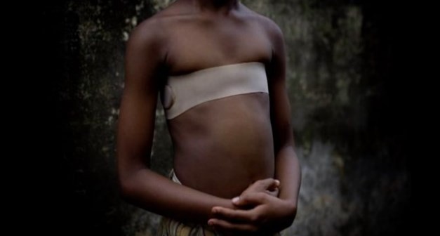 Qué es el "planchado de senos": el método africano para evitar que las nenas sean abusadas | Internacionales