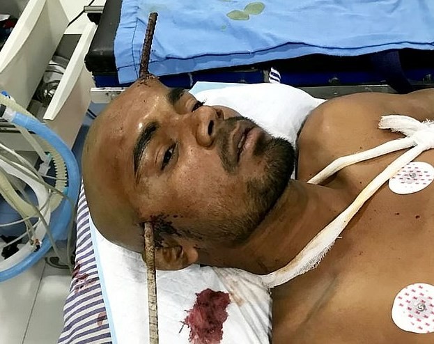 Video escalofriante: un fierro le atravesó la cabeza y sobrevivió de milagro | Curiosidades