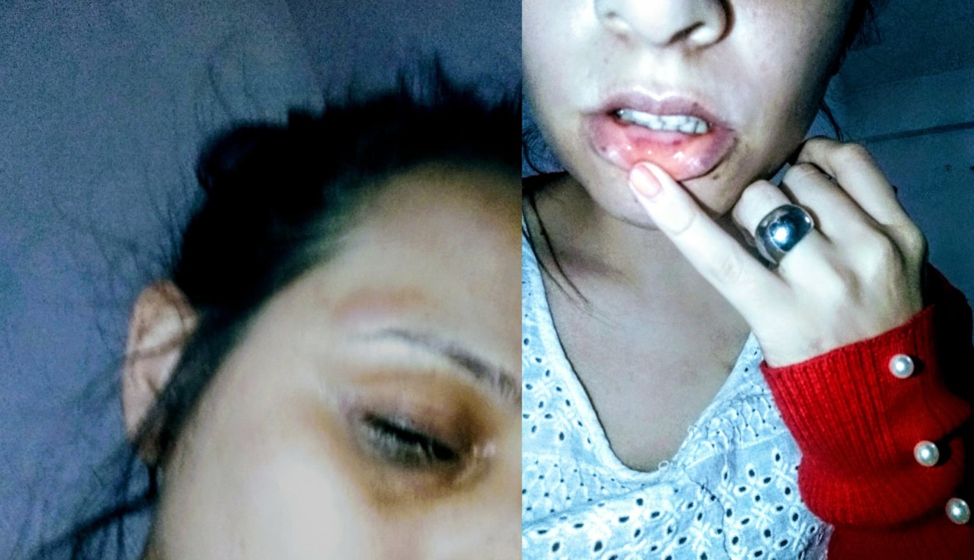 Denunció 11 veces a su ex por violencia de género y no recibe ayuda: “Vivo encerrada y con miedo” | Actualidad