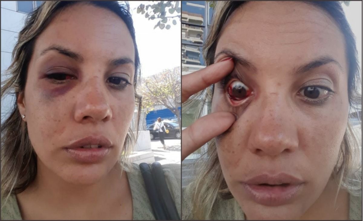 Denunció a su ex pareja por violencia de género y la Justicia le pide que haga "autocrítica" | Actualidad