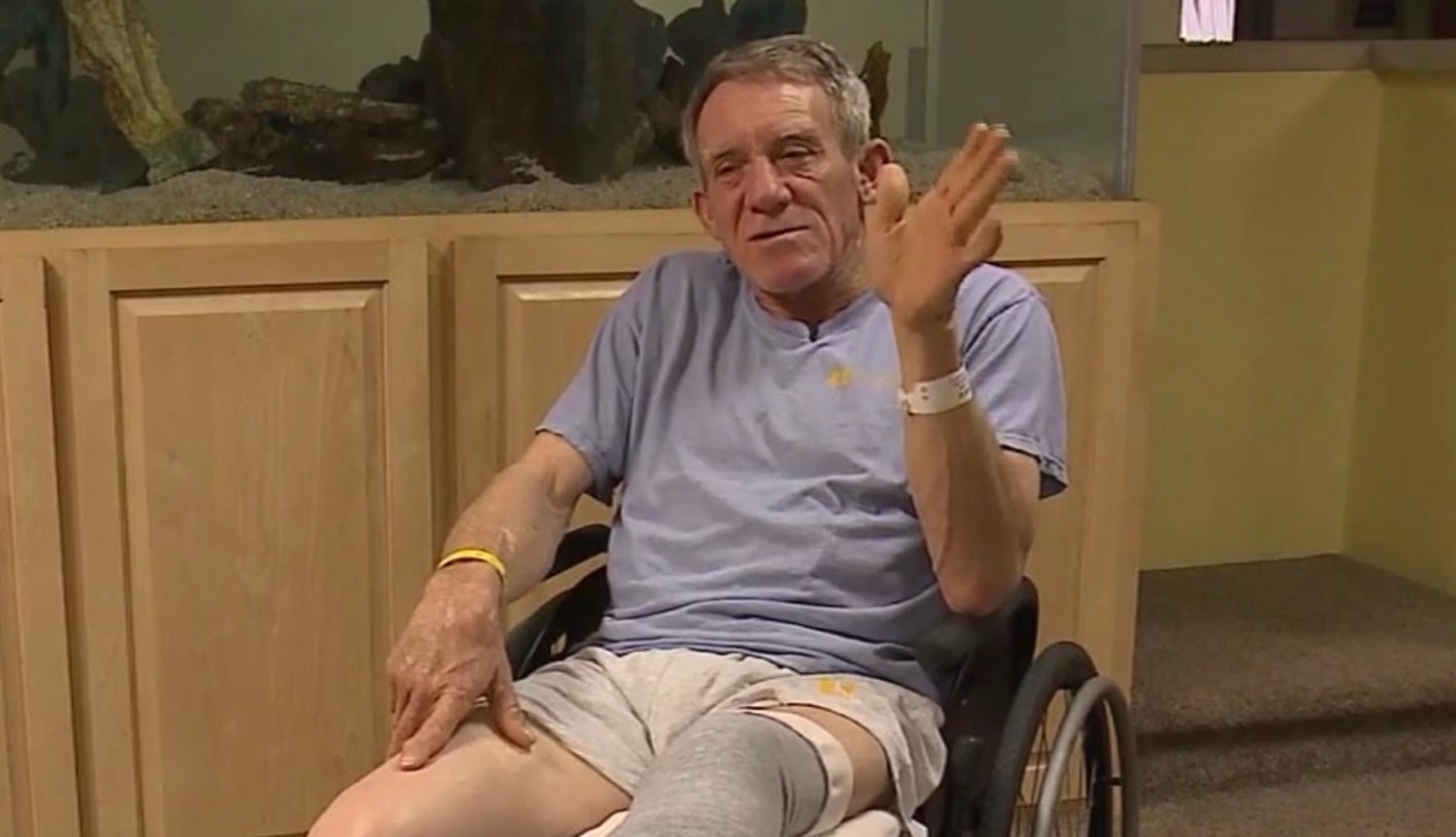 Agricultor se amputó la pierna con un cuchillo al quedar atrapado en una máquina | Internacionales