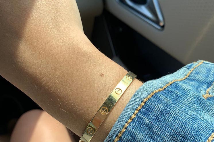 El enigma viral que asegura que todas las mujeres tienen un lunar en la muñeca | Curiosidades