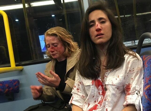 "Querían que nos besáramos": brutal paliza a una azafata uruguaya y a su novia | Internacionales