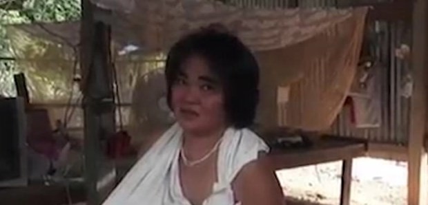 El extraño caso de la mujer a la que no le paran de crecer los pechos | Curiosidades