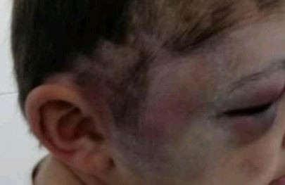 Un nene de 3 años llegó así a la guardia del hospital: le dieron la custodia al abuelo | Actualidad