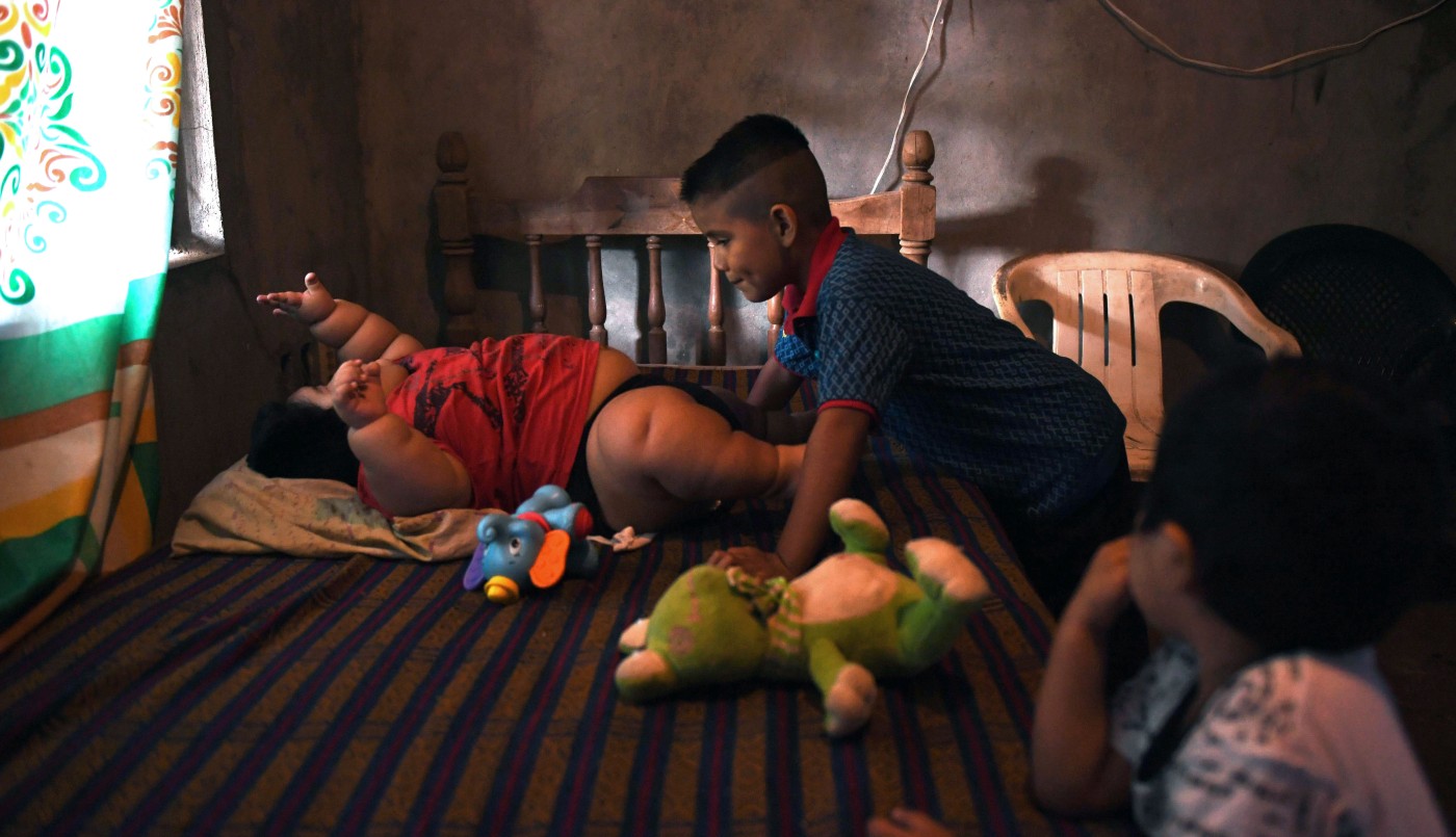 Obesidad y hambre, los dos grandes males de América Latina | Internacionales