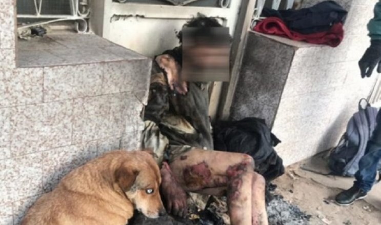 Brutal ataque en Santa Fe: prendieron fuego a un hombre en situación de calle | Actualidad
