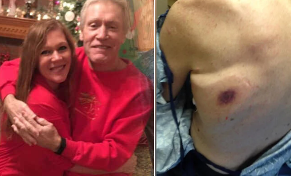 Nuevo caso mortal de la "bacteria come carne": un hombre falleció en 48 horas | Internacionales