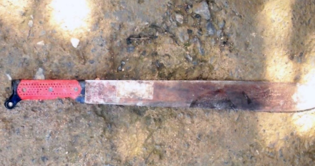 Encontró a su esposa teniendo sexo con el amante y le cortó el pene con un machete | Actualidad
