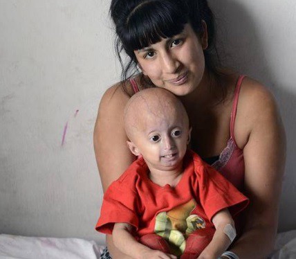 La triste historia del nene argentino que envejeció de golpe | Actualidad