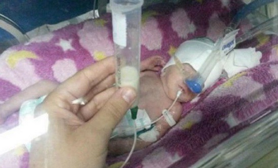 Córdoba: se recupera la beba que pesó 480 gramos al nacer | Actualidad