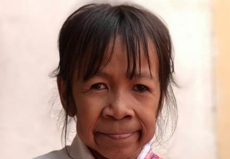 El extraño caso de la nena con "cara de abuela" | Curiosidades