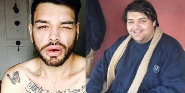 El joven que se operó 27 veces para parecerse a Ricky Martin | Espectáculos