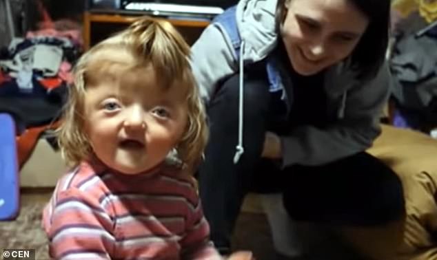 Le prohíben ingresar a un jardín a una nena con el cráneo deformado | Internacionales