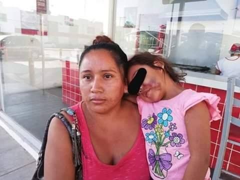 Fue a buscar a su hija al jardín de infantes y se la entregaron con la cara desfigurada | Internacionales