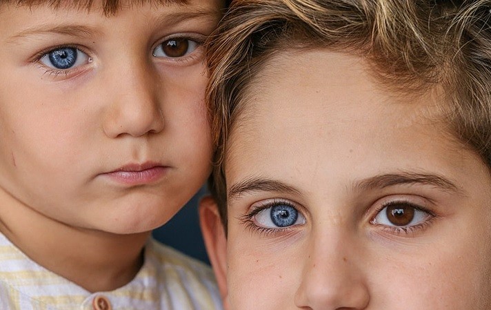 El extraño caso de los hermanos que nacieron con un ojo de cada color | Curiosidades