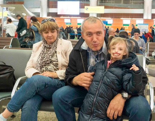 La nena que nació sin la mitad de la cara pudo sonreír por primera vez | Curiosidades