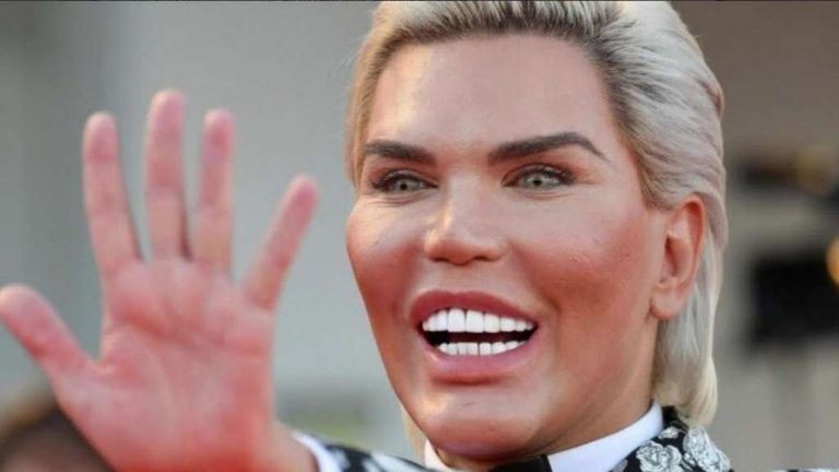 El "Ken humano" está por perder su nariz por las 72 cirugías a las que se sometió | Curiosidades