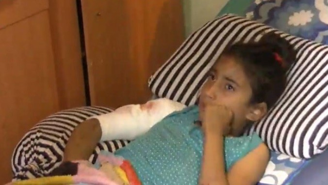 Un  rottweiler atacó a una nena de 9 años y está viva "de milagro" | Actualidad