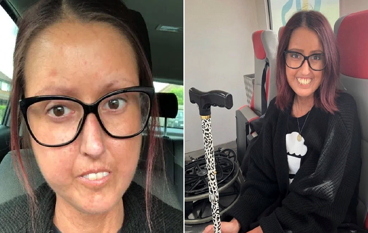 La rara enfermedad que endurece la piel: el drama de Georgina | Internacionales