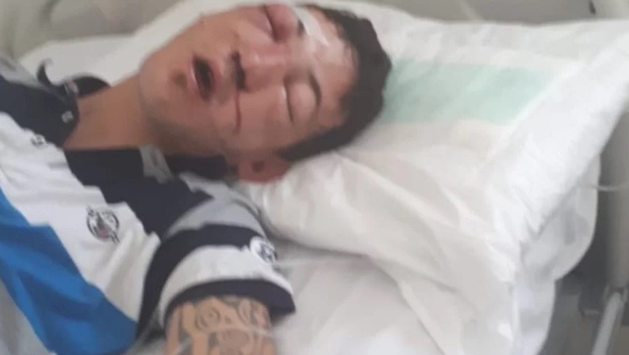 Quiso defender a una chica a la salida de un boliche y dos policías lo molieron a golpes | Actualidad