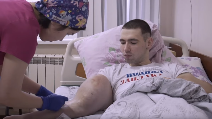 El Popeye ruso inició el camino para que sus brazos vuelvan a la normalidad | Internacionales