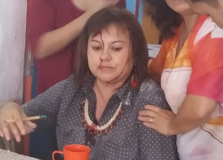 Cayó la mampostería del techo de una escuela sobre una docente que daba clases | Actualidad