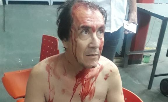 Un chofer de la línea 140 sufrió brutal asalto | Actualidad