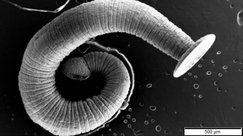 Un hombre tuvo durante 13 años un gusano de 12 centímetros en su cerebro | Curiosidades