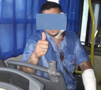 Feroz ataque a un chofer de la ínea 284: "Me gatillaron en la nuca" | Actualidad