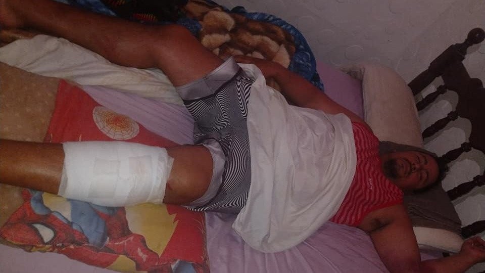 Verano de terror: se rompió un tobogán de agua en Mar del Plata y una pareja sufrió heridas | Actualidad