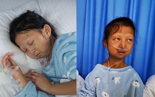 Murió la joven de 24 años que comía solo arroz para poder pagar el tratamiento médico de su hermano | Internacionales