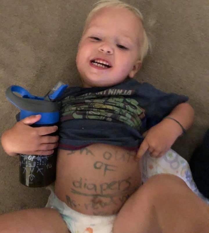 Indignante: escribieron con marcador la piel de un bebé para dejarle un mensaje a su mamá | Internacionales