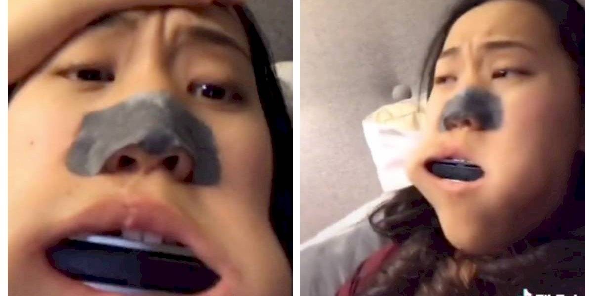 Hizo una broma, se metió una armónica en la boca y nunca pudo sacársela | Curiosidades