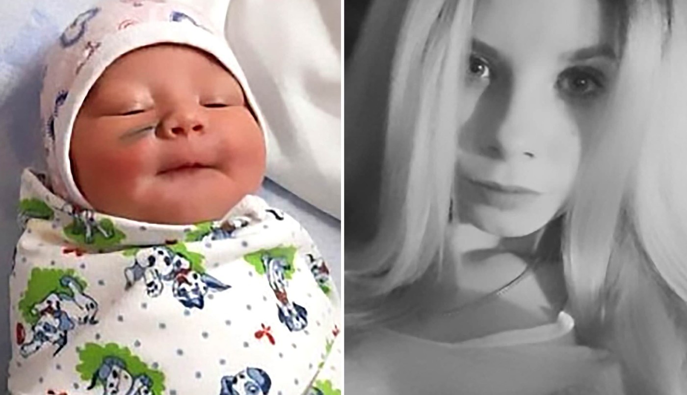 Le cortaron la cara a una bebé recién nacida durante la cesárea | Curiosidades