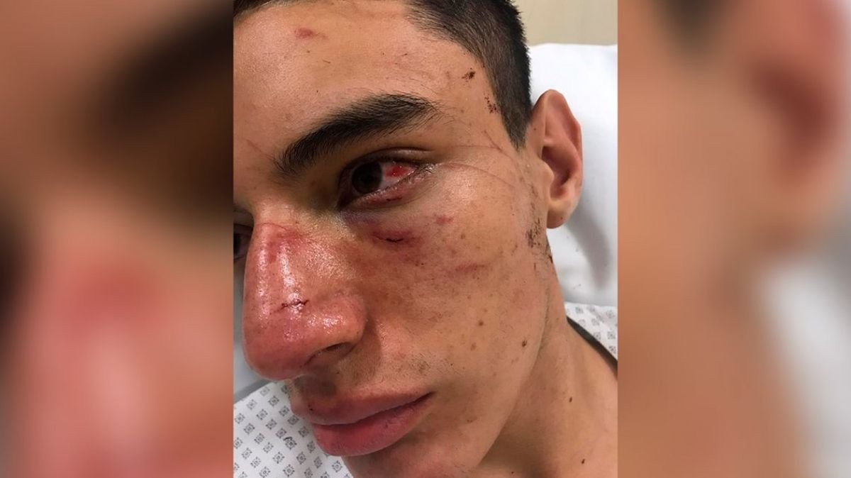 Un rugbier sufrió una brutal golpiza y sugirió que hubo "ensañamiento" por el crimen de Fernando | Actualidad