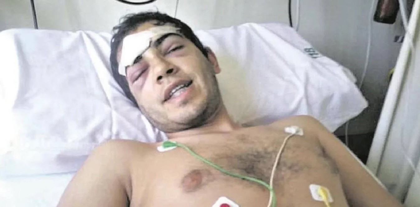 Otra brutal golpiza a la salida de un boliche: está internado con fractura de cráneo | Actualidad