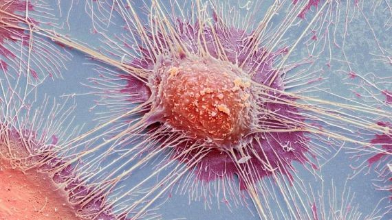 Un estudio del genoma del cáncer abre la posibilidad de detectarlo antes de que aparezca | Internacionales