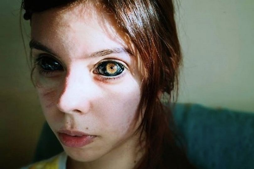 Una chica quiso imitar a un rapero, se tatuó los ojos de negro y quedó ciega | Curiosidades