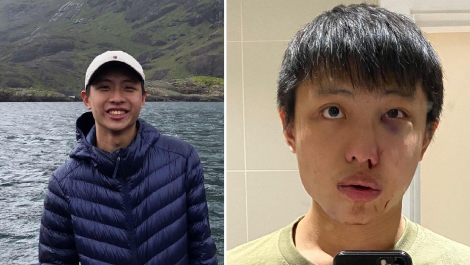 "No quiero tu coronavirus en mi país": brutal ataque a un joven en Londres | Internacionales