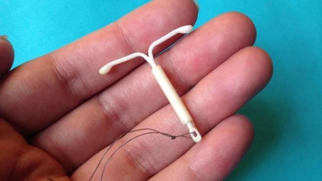 Una chica de 25 años estuvo a punto de morir por una infección generada por un DIU | Internacionales