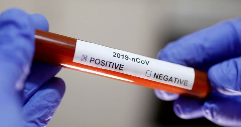 Coronavirus: cómo funcionan los test para detectar un caso positivo | Actualidad