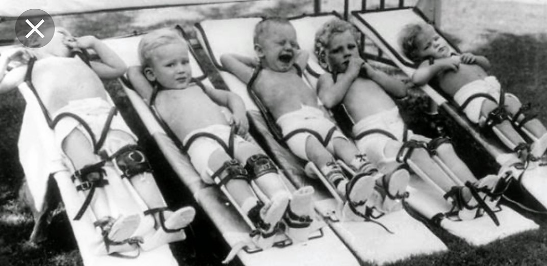 La historia de la epidemia de la Polio y una vacuna que salvó a la humanidad | Actualidad