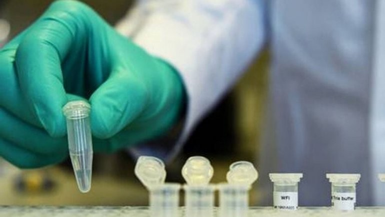 Empiezan a tratar con plasma a pacientes graves de coronavirus en Argentina | Actualidad