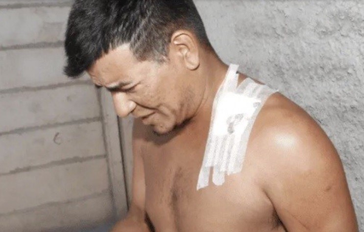 Lo apuñaló su novia y a las pocas horas la perdonó: "acá, con mi tóxica..." | Actualidad