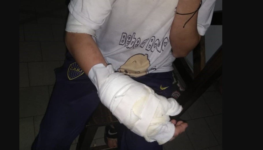 Prendíó fuego a su pareja cuando tenía en brazos a la beba de ambos | Actualidad