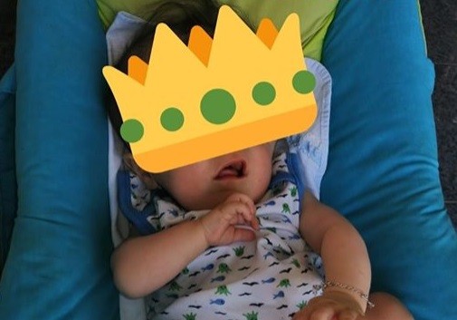 Rodrigo, el "bebé sin rostro", cumplió 7 meses: le habían pronosticado pocas horas de vida | Internacionales