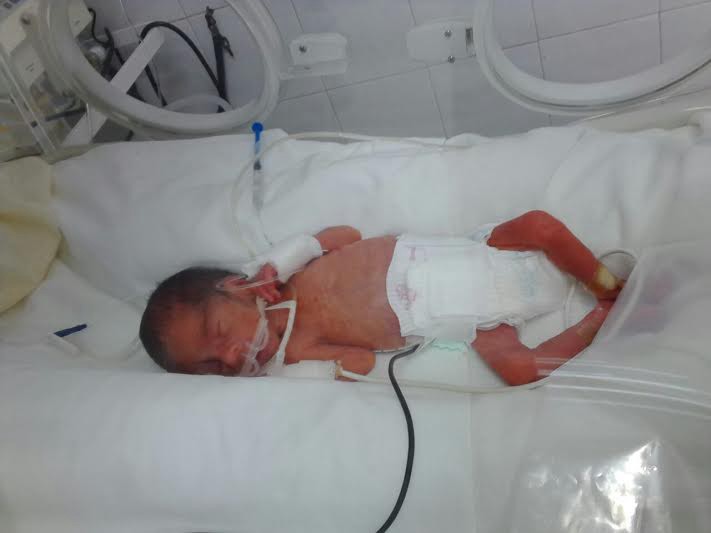 La historia del bebé al que resucitaron tras "nacer muerto" | Actualidad